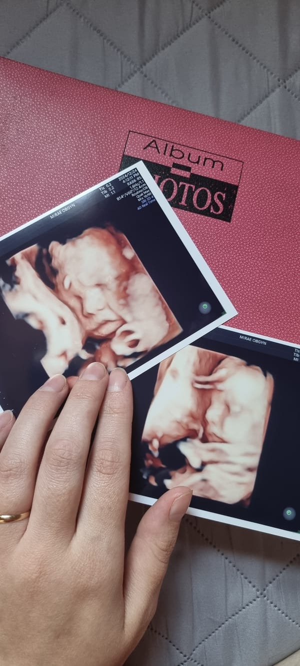 Ultrasound photos placed on pink album in South Korea