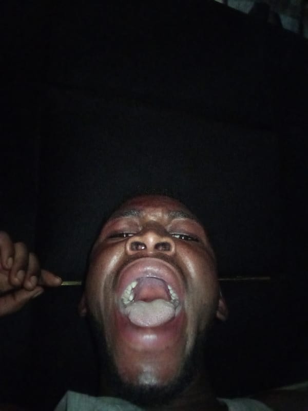 Man caught mid-expression with mouth wide open in Lokoja
