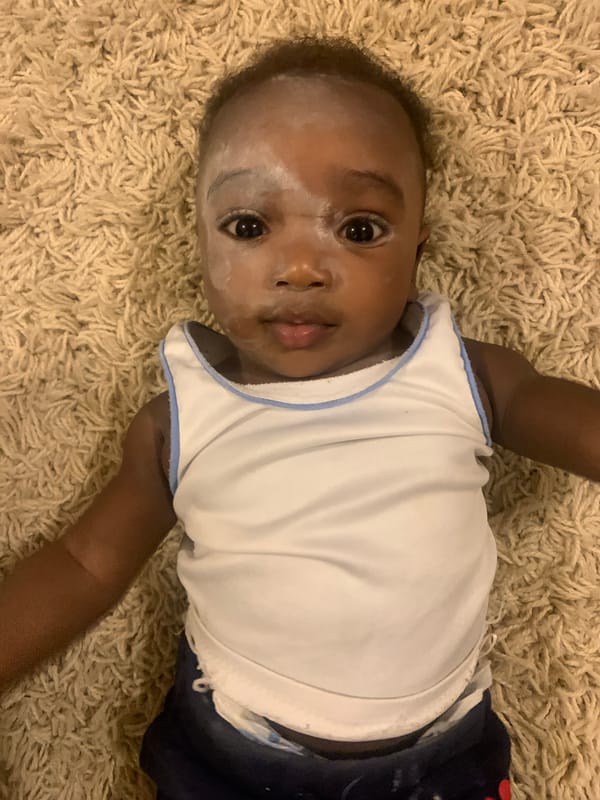 Baby with powdery substance observed on carpet in Nigeria
