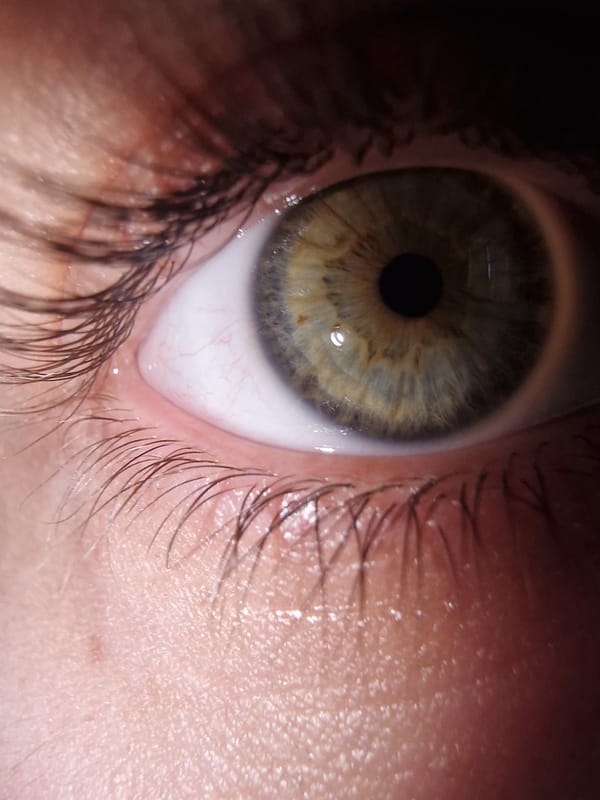 Close-up eye images captured by witness in two-minute span