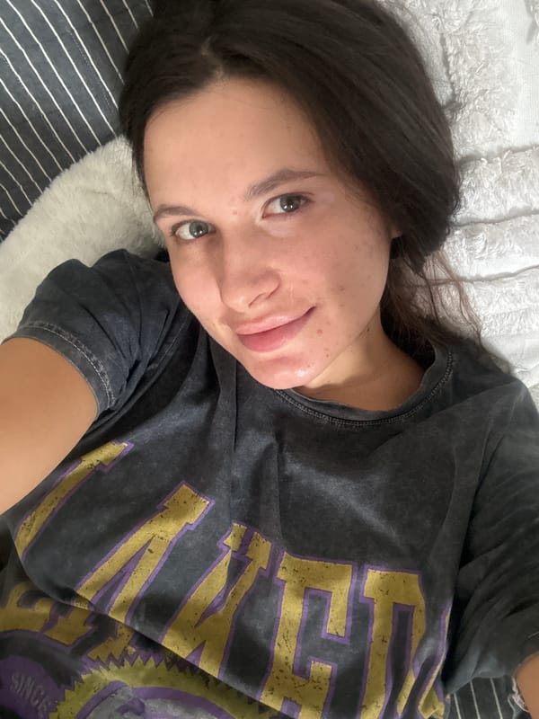 Woman resting on bed observed in Akulovo, Russia