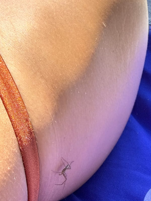 Tiny spider-like insect resting on skin, Zelenogorsk