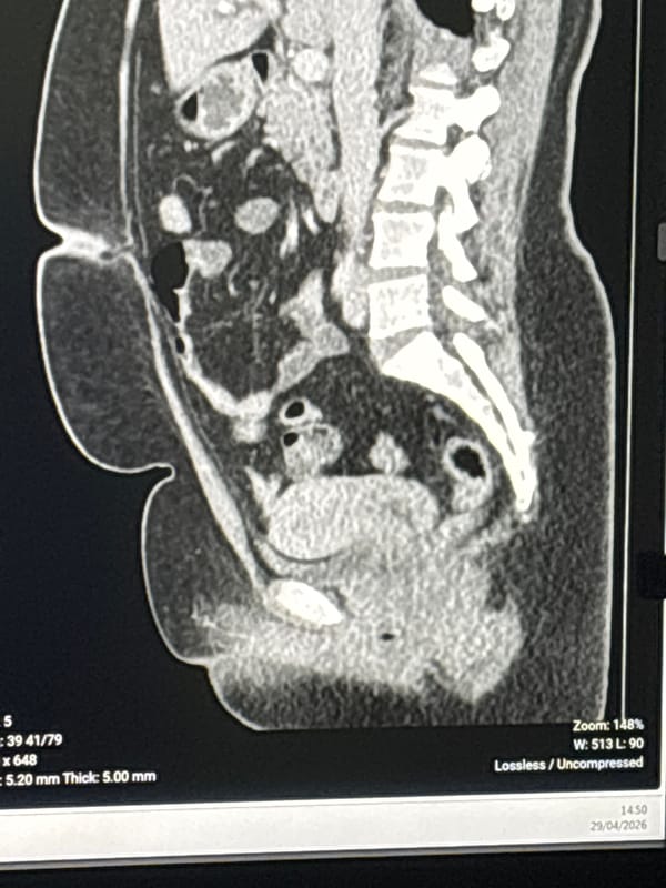 Medical CT scan documented in Medellín
