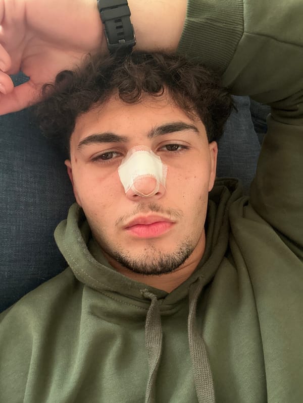 Young man with nose bandage photographed in Damascus suburb