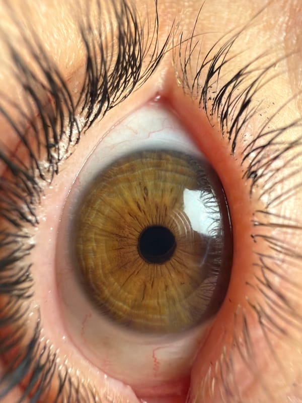 Macro eye photography session documented in North Kuta