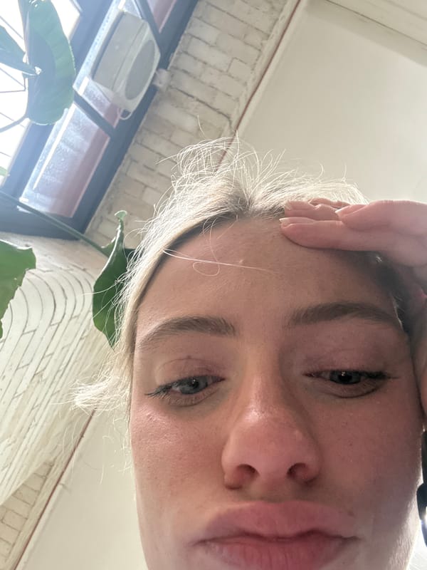 Person photographed with hand on forehead in Manchester