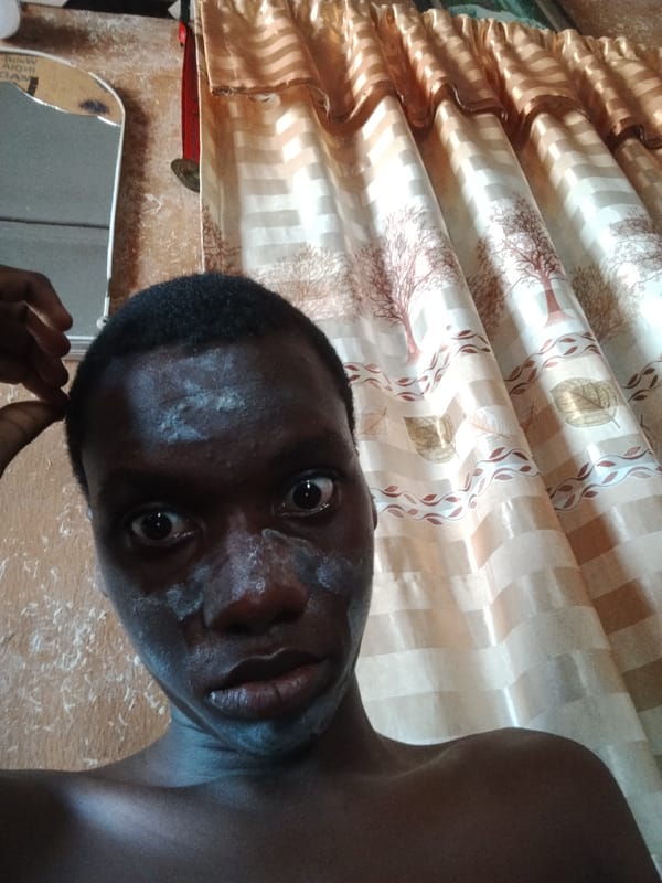 Young man documents skincare routine at home in Shangisha