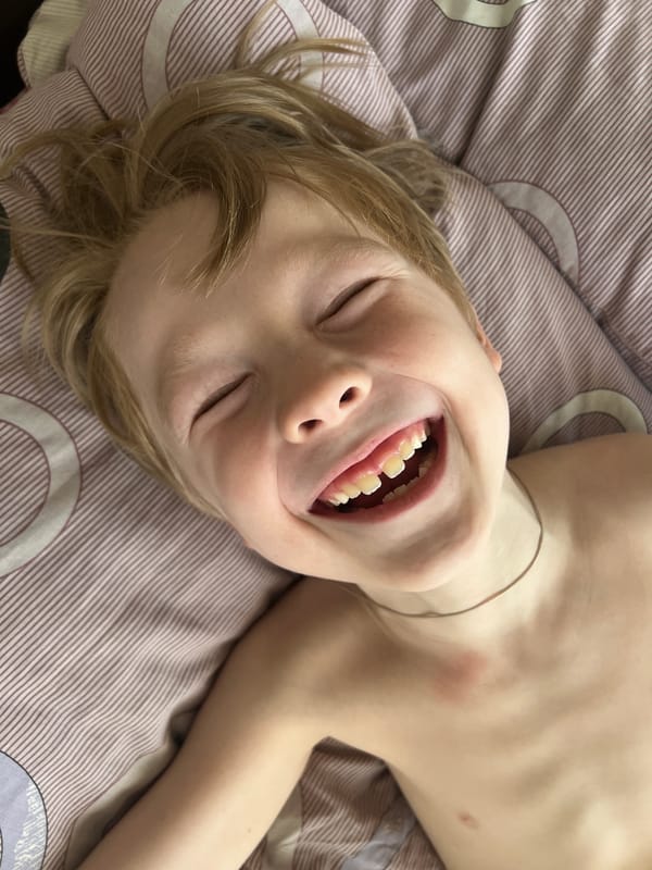 Child rests peacefully on striped bedding in Chemoshur