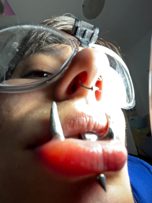 Person documents dental lab visit in Sofia with selfies