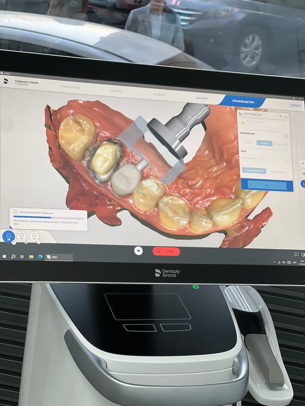 Dental procedure with digital milling equipment documented in Yerevan