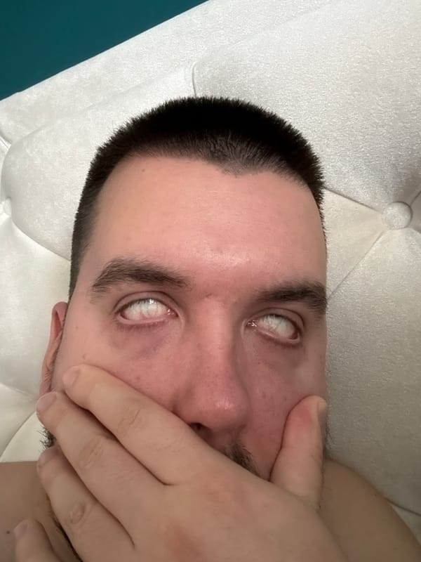 Sofia resident documents hangover experience on social media