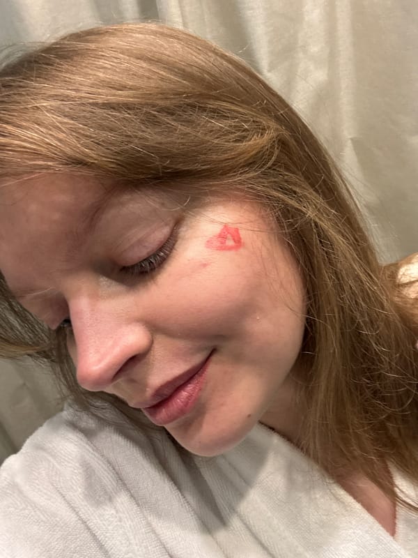 Person photographed in two poses during six-minute span