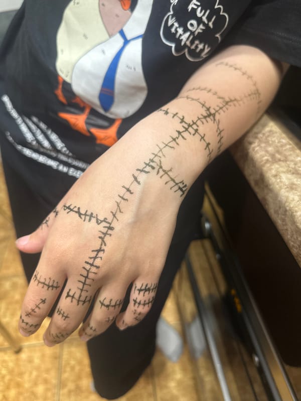 Resident documents daily life including stitch-art body drawings in Sayanogorsk