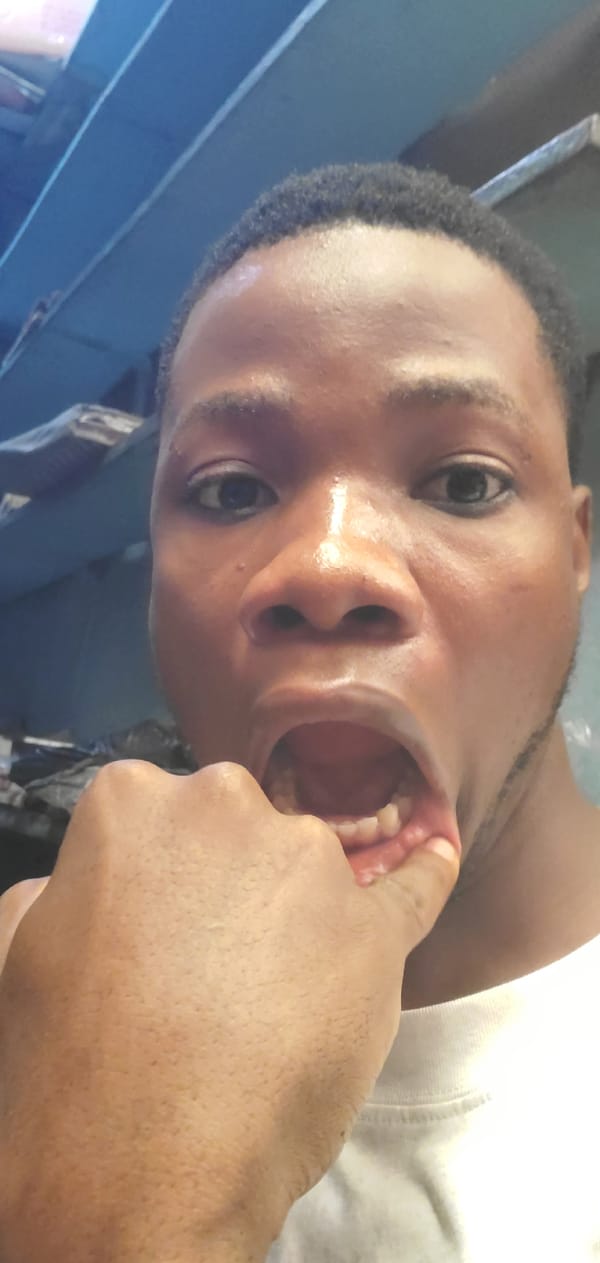 Young man photographed making playful expressions in pharmacy setting