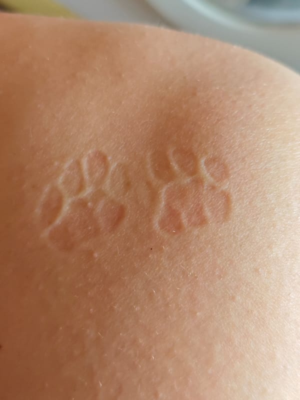 Sphynx cat leaves paw prints on human in Pyatigorsk