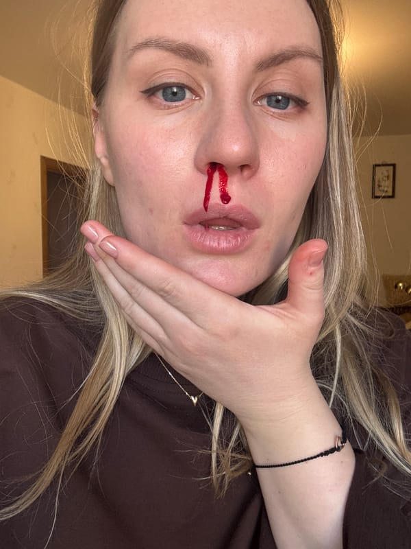 Woman experiences nosebleed in Moscow