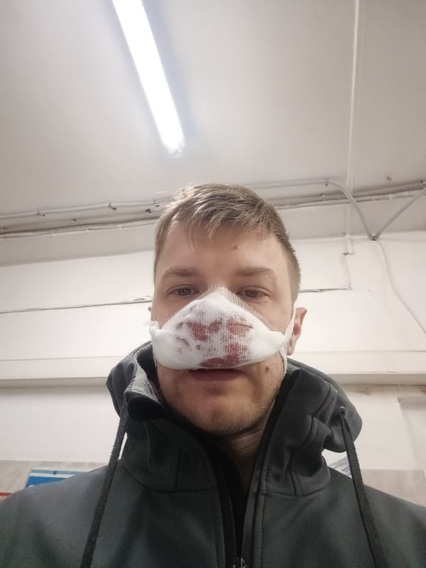 Man spotted indoors wearing nose bandage in grey hoodie
