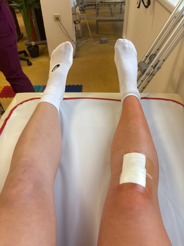 Knee injury recovery coincides with birthday celebration in Sofia
