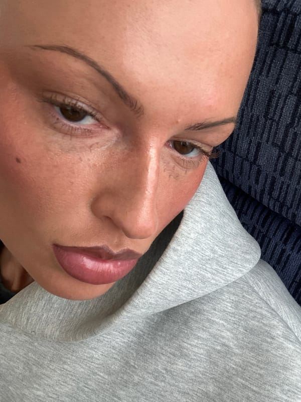 Close-up selfie captured in London showing partial facial features