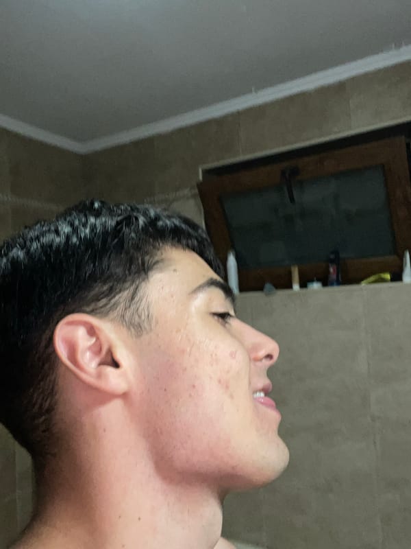 Young man photographed looking upward in profile view