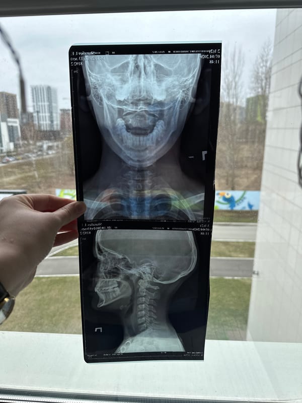 Person examines medical x-rays at window in Kazan
