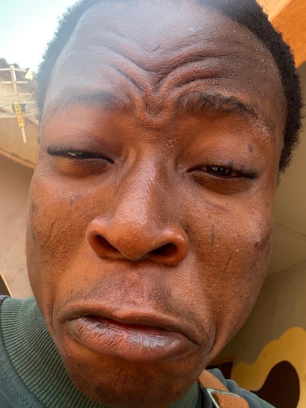 Person with perspiration observed in close-up at location 666