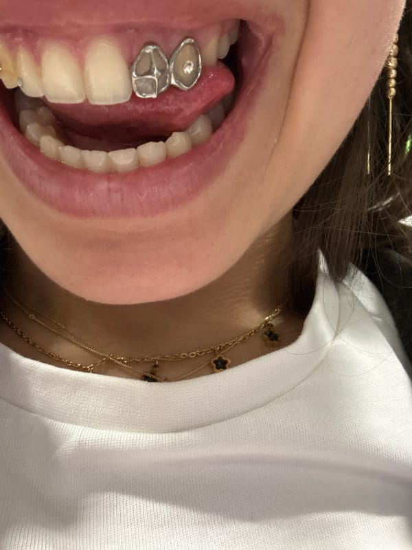 Person documents dental bridge in close-up mouth photo