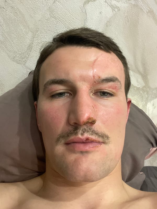 Injured man with facial wounds documented in Sochi