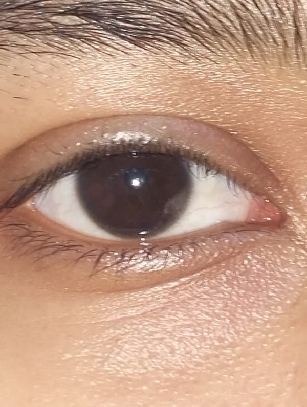 Traditional coconut preparation and beverage documented in Dhaka