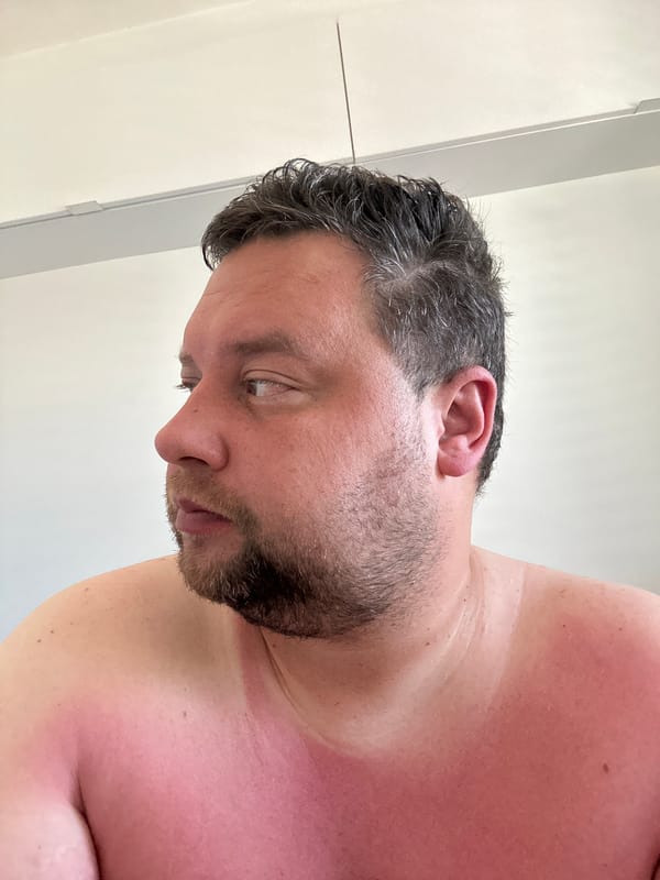 Sunburned man photographed indoors in Sant Feliu de Guíxols