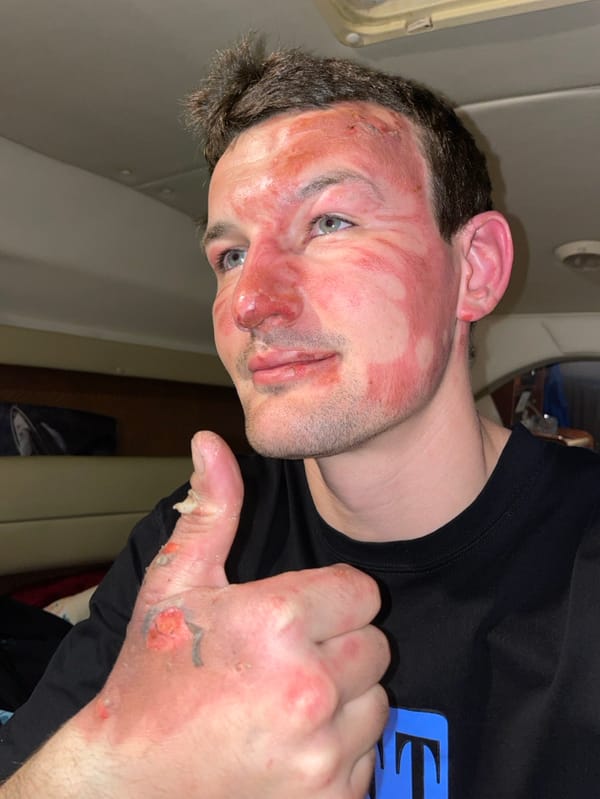 Injured man documented in boat cabin, Sochi Russia