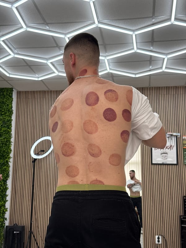 Sofia barbershop busy with cupping therapy and regular services