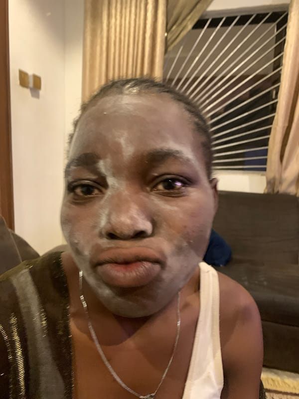 Woman documents skincare routine with facial mask in Jos