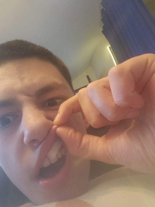 Person manipulates lip, bares teeth in upward-angled observation