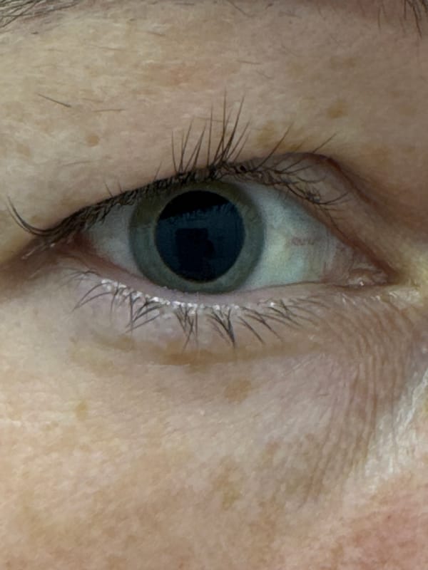 Selfies and close-up eye shots at a Chaikovsky clinic
