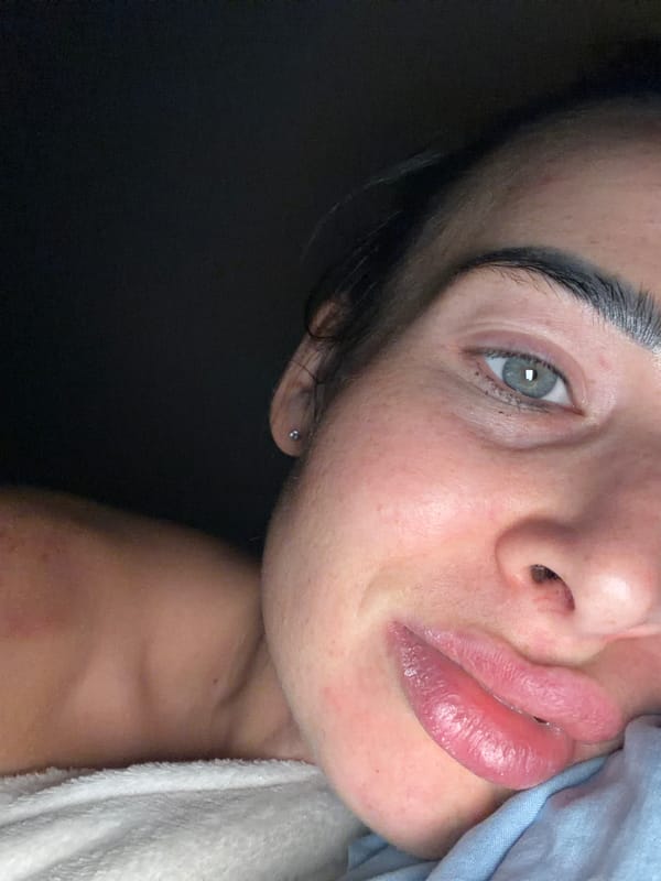 Woman receives skincare treatment in Saint Petersburg session
