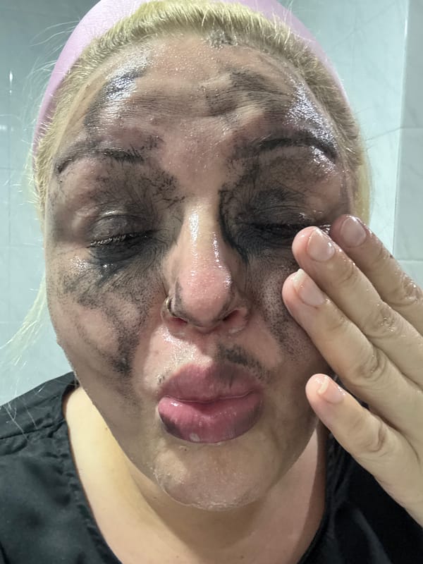 At-home skincare routine documented in close-up selfies, Batumi