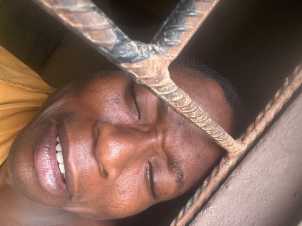 Person photographed making various expressions near metal bars