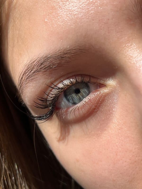 Close-up eye photograph documented in Foki, Russia