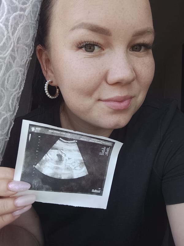 Woman holds ultrasound photo, baby photographed in Kuyeda, Russia