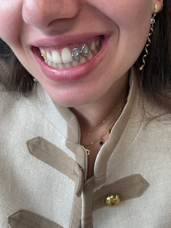 Person with braces photographed in casual video shoot, Lomazzo
