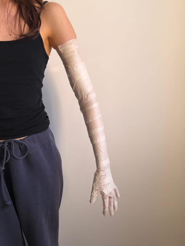 Person creates homemade paper arm cast in Milan