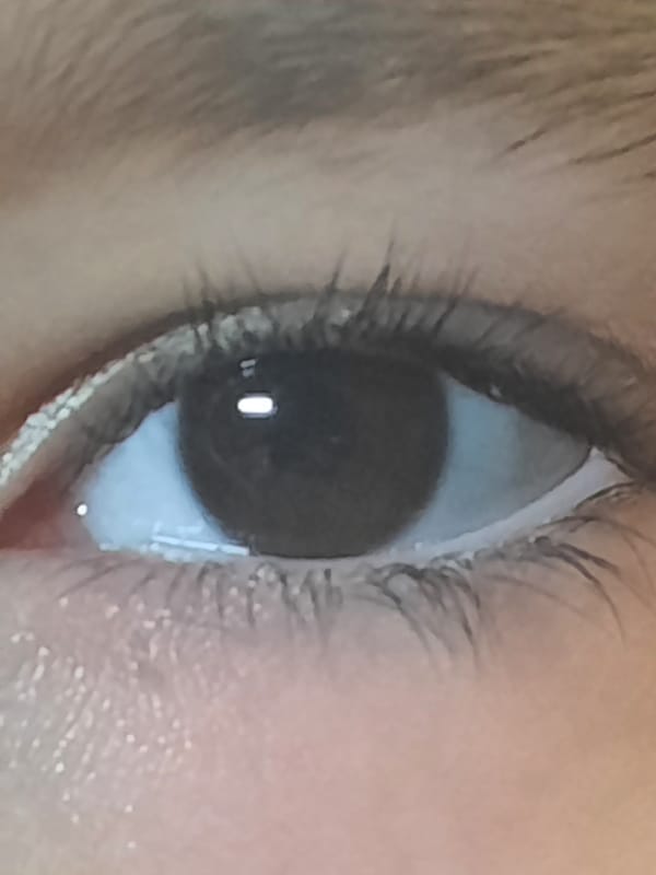 Close-up photograph of human eye captured by witness