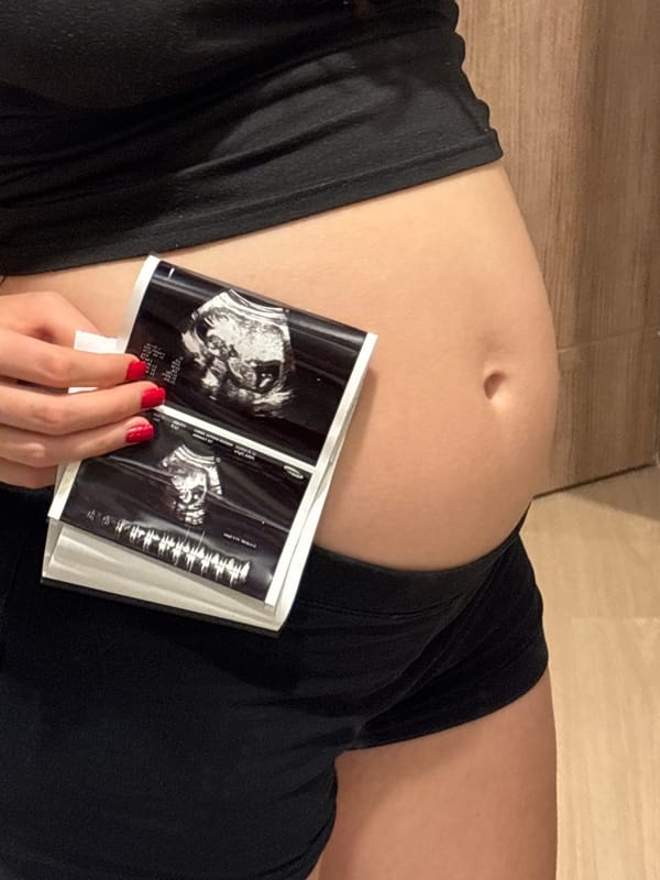 Pregnancy moment documented in Choeng Thale, Thailand