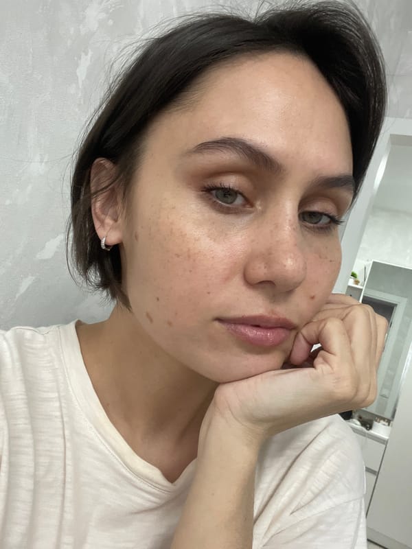 Portrait of freckled woman photographed in Izhevsk, Russia