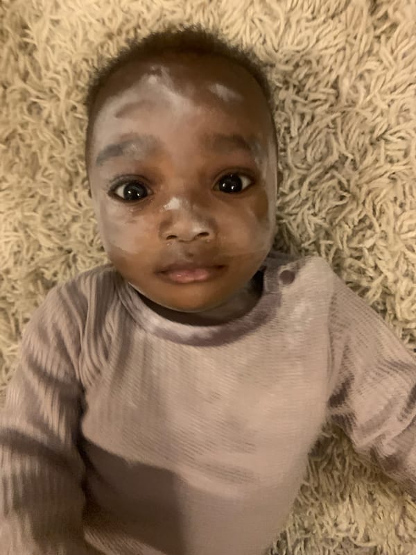 Baby with white face cream rests on rug in Nigeria