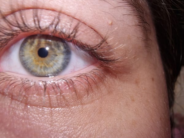 Macro eye photography session documented in 45-minute span