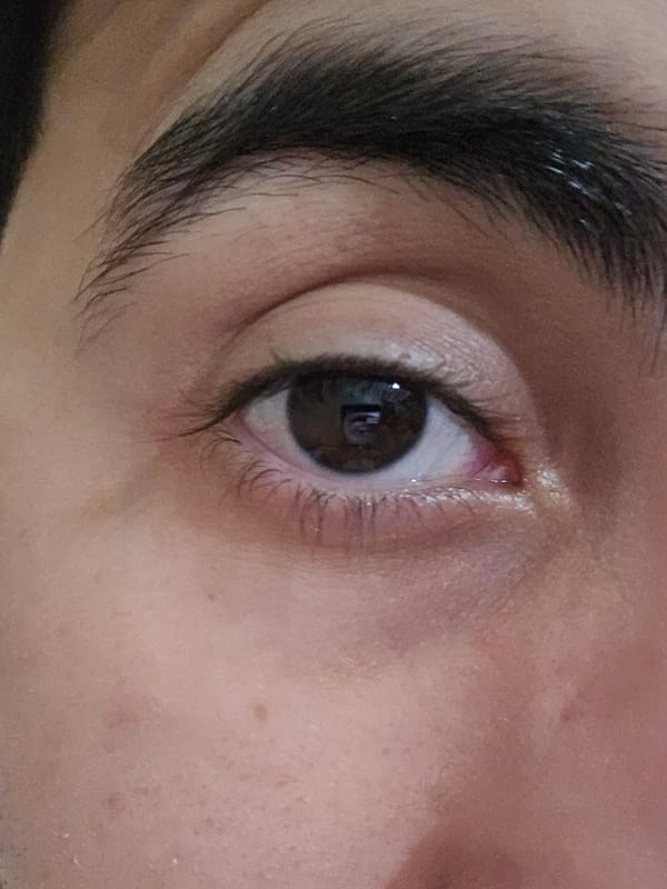 Witness captures intimate moments: human eye, baby chick in Fez