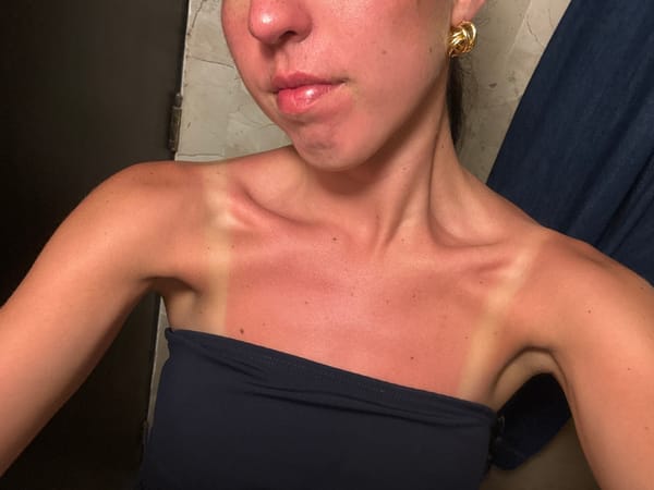 Social gathering and sunburn incidents documented overnight