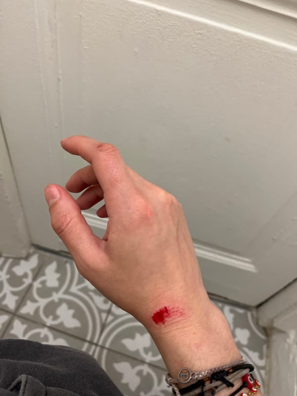 Injured person with bleeding wrist observed in Lyon